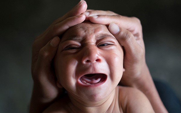 研究發(fā)現(xiàn)寨卡病毒誘發(fā)小頭癥的直接證據(jù)，但疫苗還是沒影｜美通社頭條